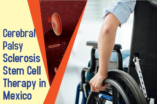 Cerebral Palsy Stem Cell treatment in Mexico