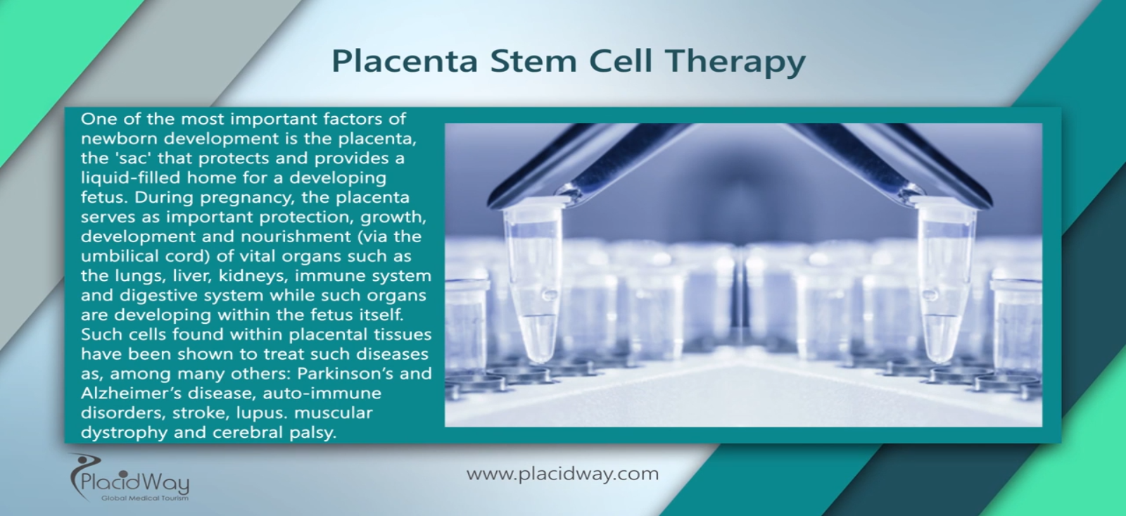 lung stem cell treatment cost