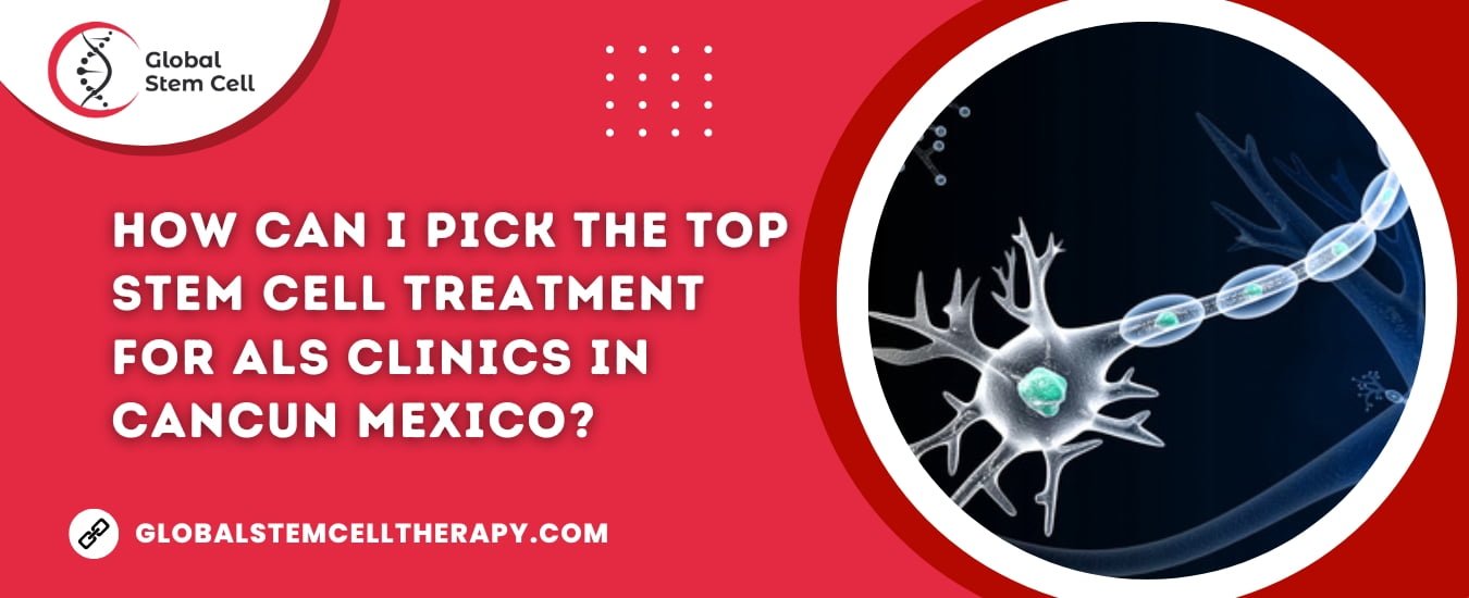 Stem Cell Treatment for ALS in Cancun Mexico