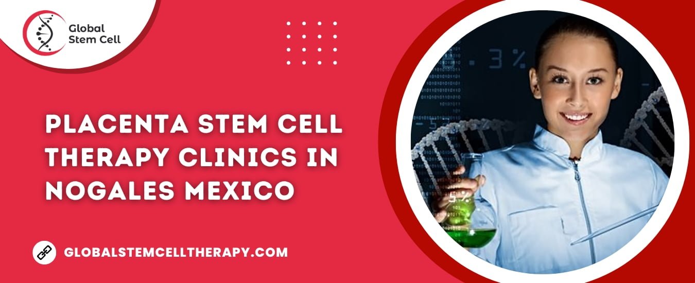 Placenta Stem Cell Therapy clinics in Nogales Mexico