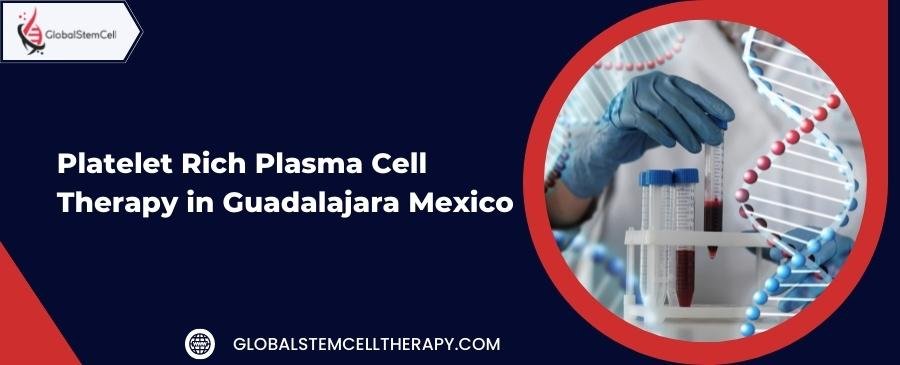 Platelet Rich Plasma Cell Therapy in Guadalajara Mexico