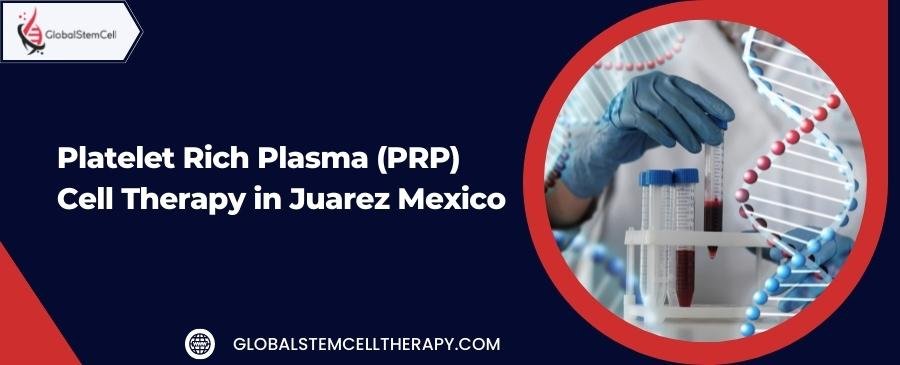 Platelet Rich Plasma Cell Therapy in Juarez Mexico