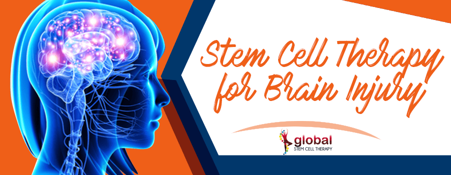 Stem Cell Therapy for Brain Injury in Tijuana, Mexico