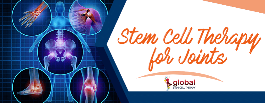 Stem Cell Therapy for Joints