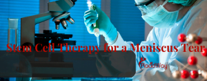 Stem Cell Therapy for a Meniscus Tear