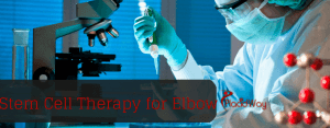 Stem Cell Therapy for Elbow