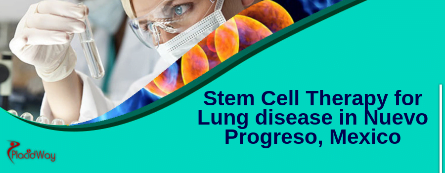 Stem Cell Therapy for Lung disease in Nuevo Progreso, Mexico
