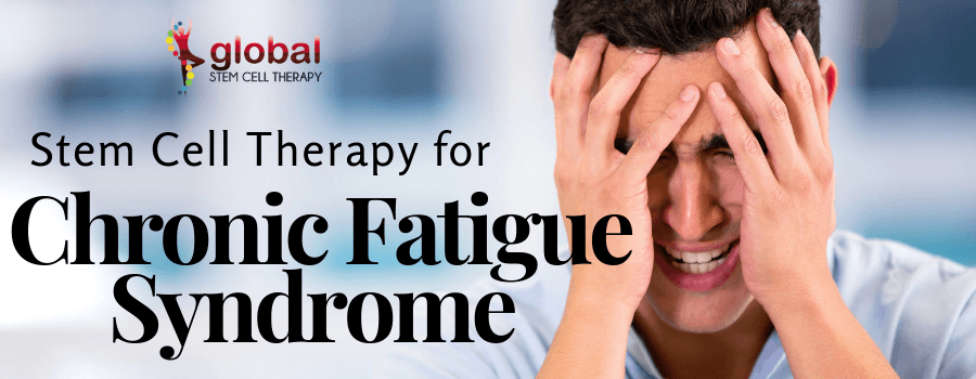 Stem Cell Treatment for Chronic Fatigue Syndrome