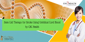 Stem Cell Therapy for Stroke Using Umbilical Cord Blood by CBC Health
