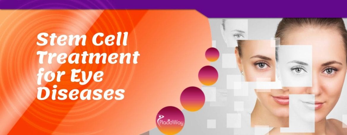 Stem Cell Treatment for Eye Diseases