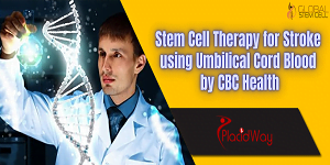 Stem Cell Therapy for Stroke using Umbilical Cord Blood by CBC Health Thumbnail