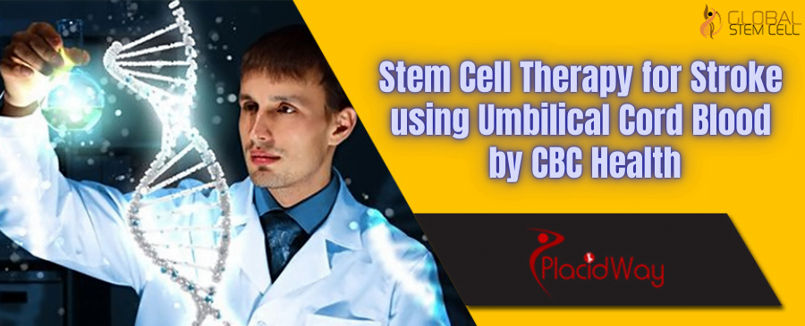 Stem Cell Therapy for Stroke using Umbilical Cord Blood by CBC Health