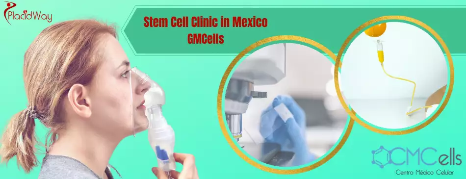 Stem Cell Therapy in Juarez Mexico - CMCells