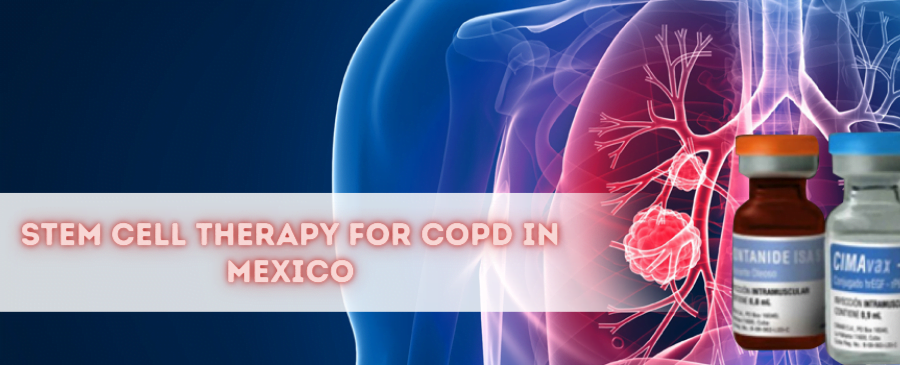 Stem Cell Treatment for COPD in Mexico