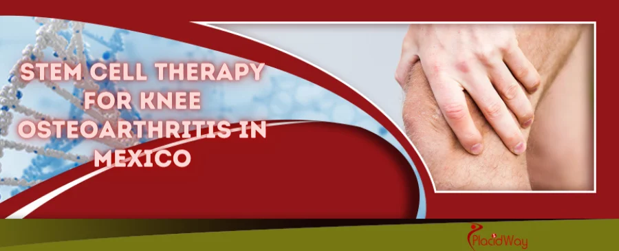 Stem Cell Therapy for Osteoarthritis of knees
