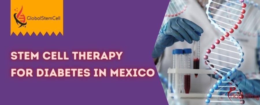 Stem Cell Therapy for Diabetes in Mexico