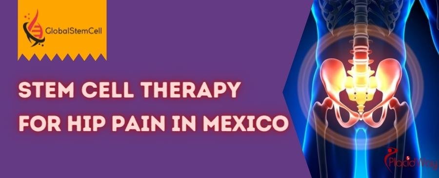 Stem Cell Therapy for Hip Pain in Mexico