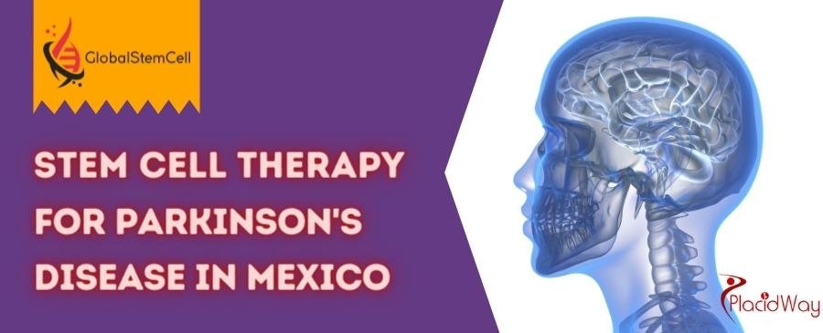 Stem-Cell-Therapy-for-Parkinsons-disease-in-mexico