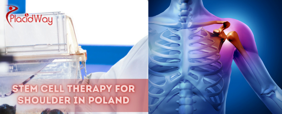 Stem Cell Therapy for Shoulder in Poland