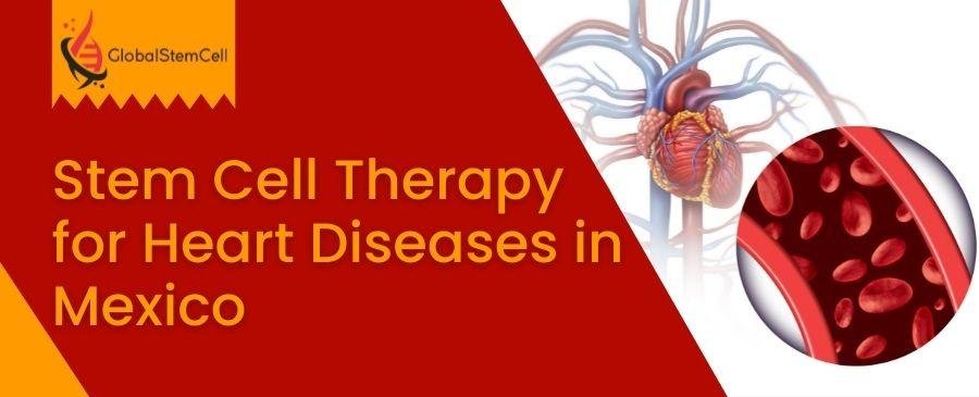 Stem Cell Therapy for Heart Diseases