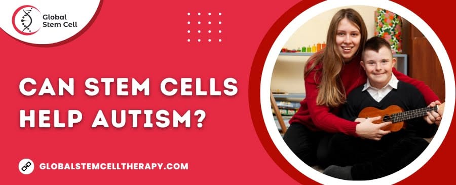 Read more about the article Can Stem Cells Help Autism?