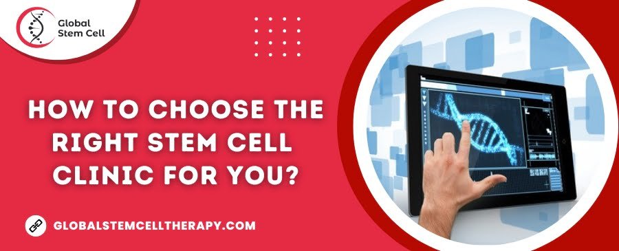 How to choose the right Stem Cell Clinic for you