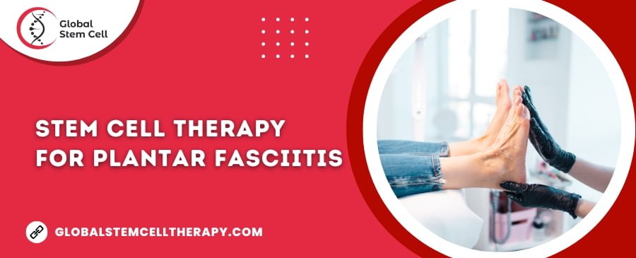 Stem Cell Therapy for Plantar Fasciitis