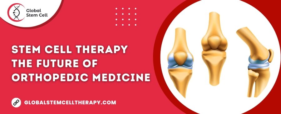 Read more about the article Stem Cell Therapy is the Future of Orthopedic Medicine