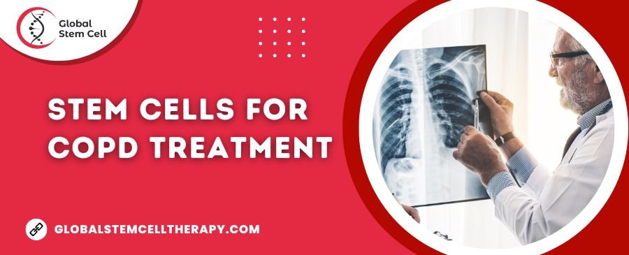 Stem Cells for COPD Treatment