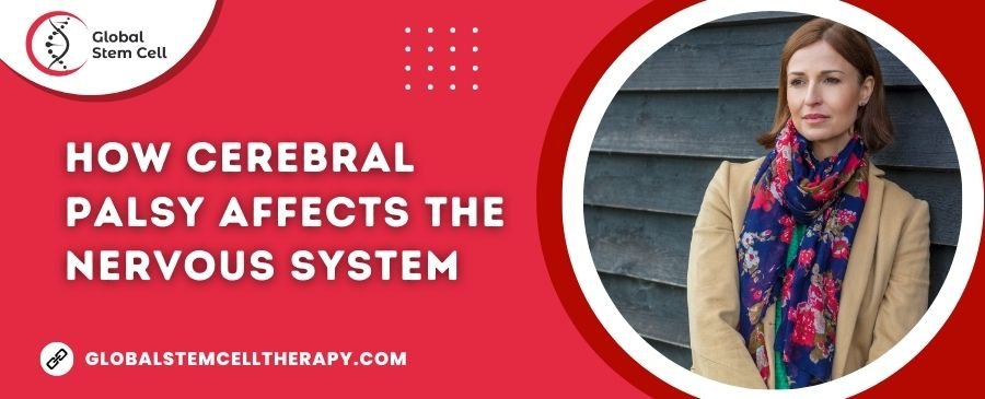 How Cerebral Palsy Affects the Nervous System