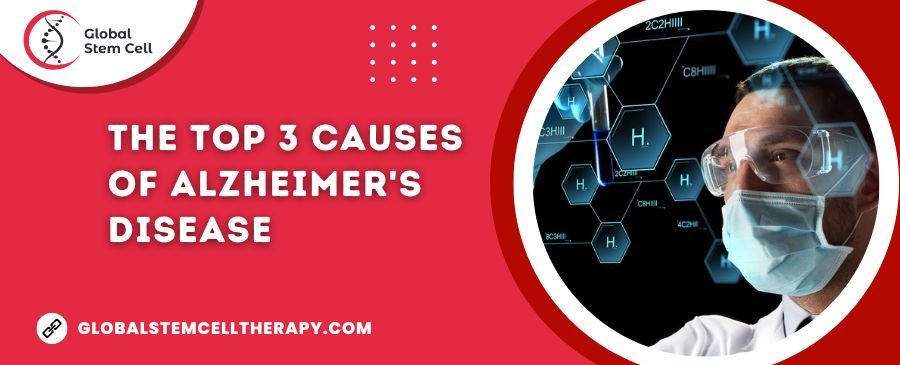The Top 3 Causes of Alzheimer's Disease
