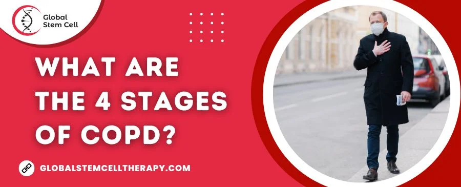 What are the 4 Stages of COPD