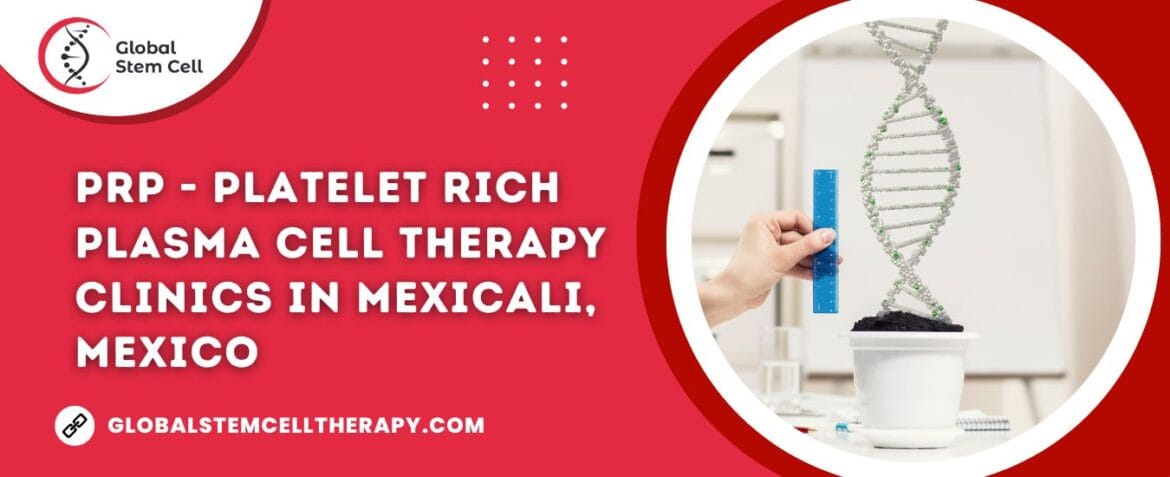 PRP - Platelet Rich Plasma Cell Therapy clinics in Mexicali, Mexico