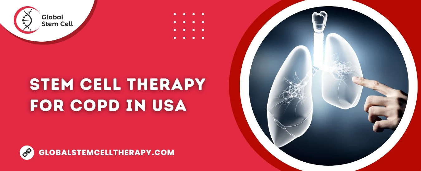 Stem Cell Therapy for COPD IN USA