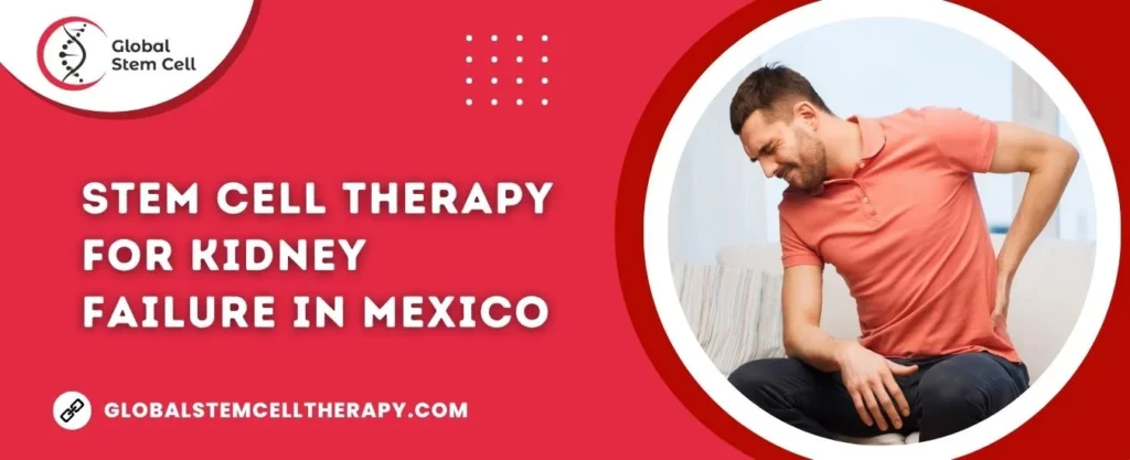 Stem Cell Therapy for Kidney failure in Mexico