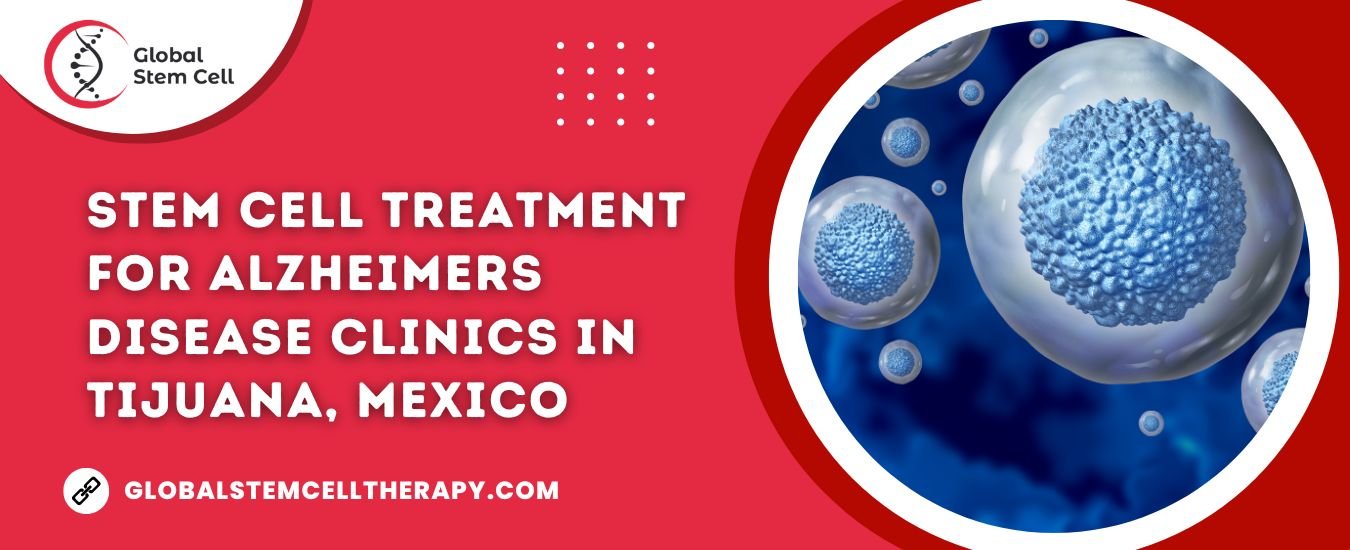 Stem Cell Treatment for Alzheimers Disease clinics in Tijuana, Mexico