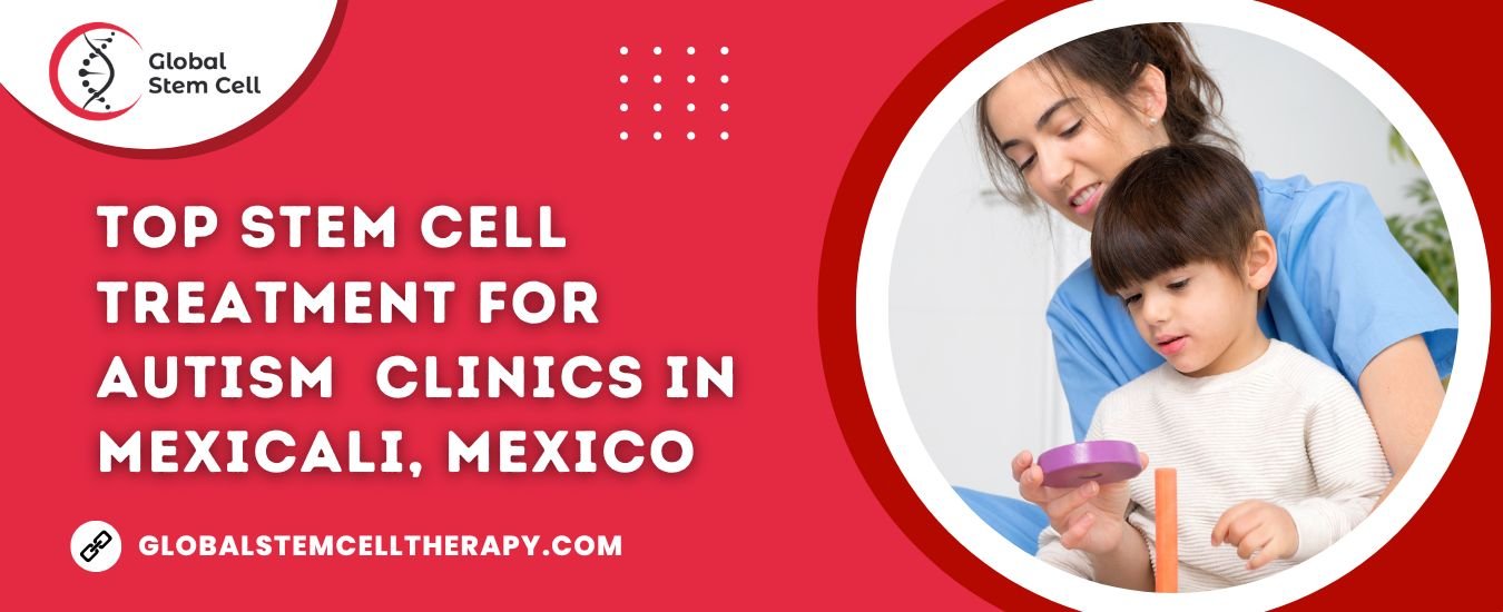 Top Stem Cell Treatment for Autism clinics in Mexicali, Mexico