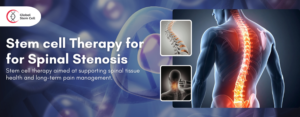 Medical Tourism Destination 2026 02 18T152626.767 Stem cell Therapy for for Spinal Stenosis
