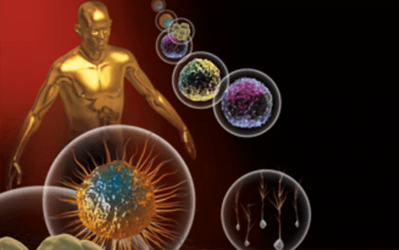 Parkinson's Disease Treatment with Stem Cell Therapy