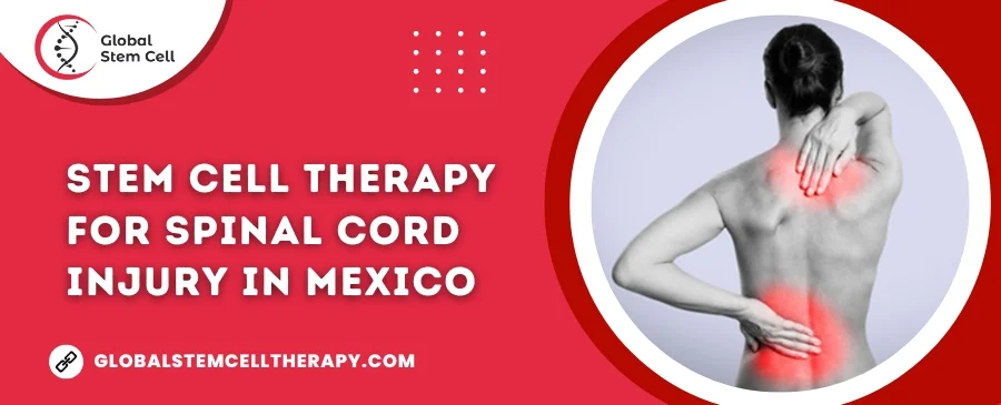 Stem Cell Therapy for Spinal Cord Injury in Mexico