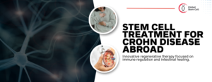 Medical Tourism Destination 2026 02 17T194643.326 Stem Cell Treatment for Crohn Disease Abroad