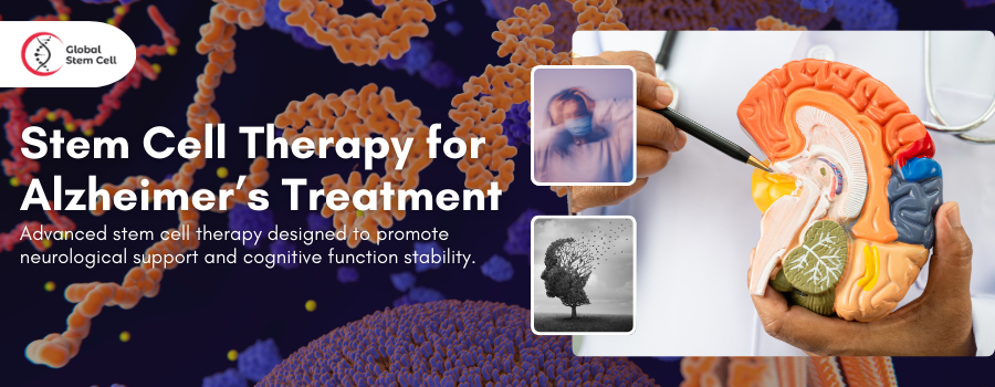 Stem Cell Therapy for Alzheimer’s Treatment