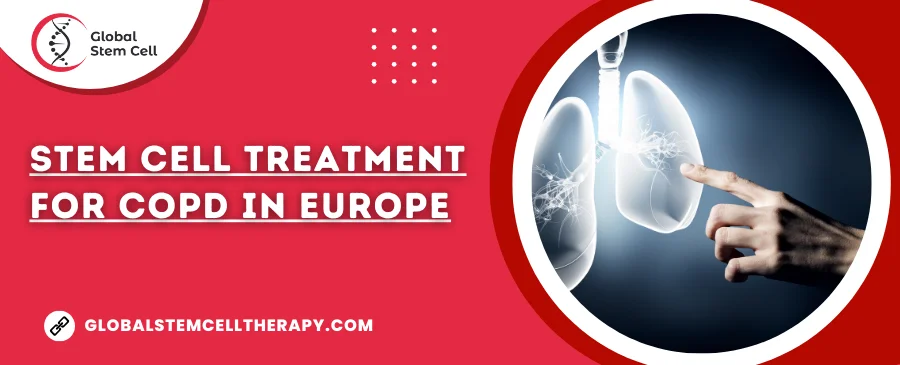 Stem Cell Treatment For COPD in Europe