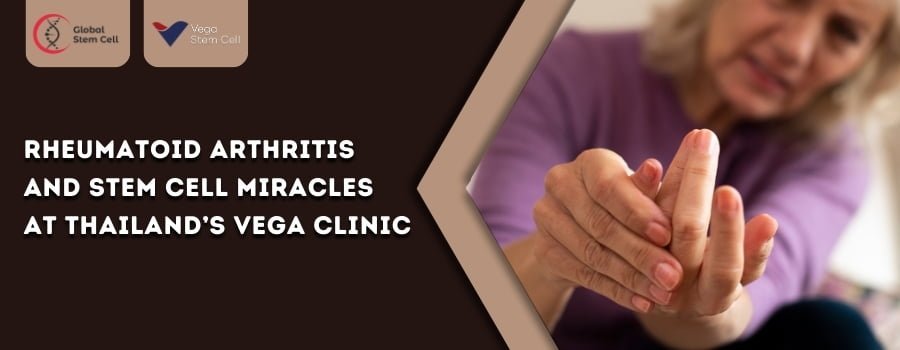 Read more about the article Rheumatoid Arthritis and Stem Cell Miracles at Thailand’s Vega Clinic