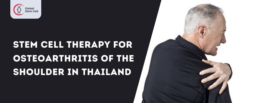Stem Cell Therapy For Osteoarthritis of the shoulder In Thailand
