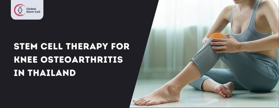 Read more about the article Affordable Stem Cell Therapy for Osteoarthritis of the Knee in Thailand