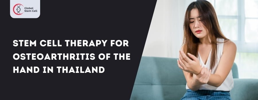 Stem Cell Therapy for Osteoarthritis of the hand in Thailand