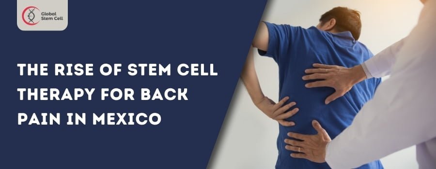 Read more about the article The Rise of Stem Cell Therapy for Back Pain in Mexico