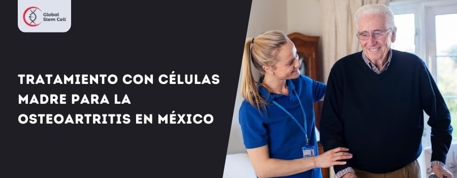 Read more about the article Tratamiento con Células Madre para la Osteoartritis en México