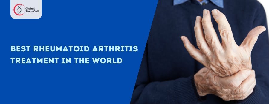 Read more about the article Best Rheumatoid Arthritis Treatment in the World